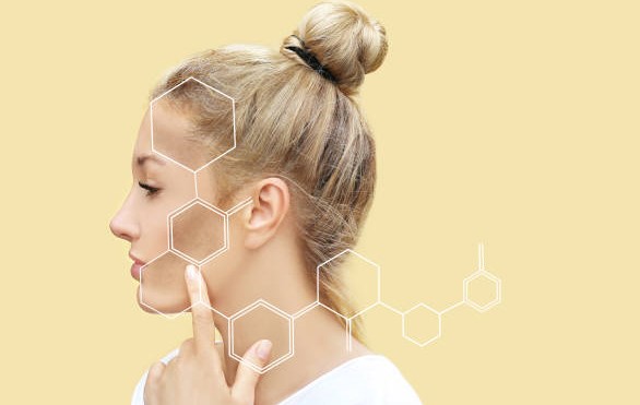 hyperpigmentation
